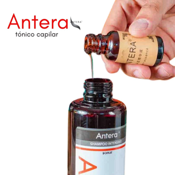 Antera